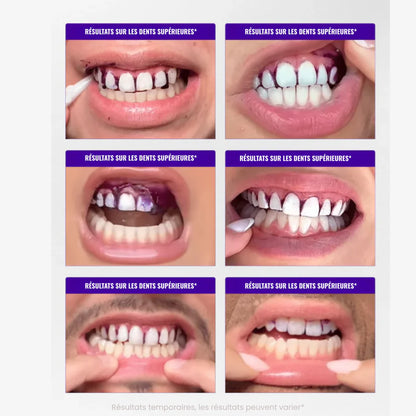 Bandes Blanchissantes PurpleWhite™