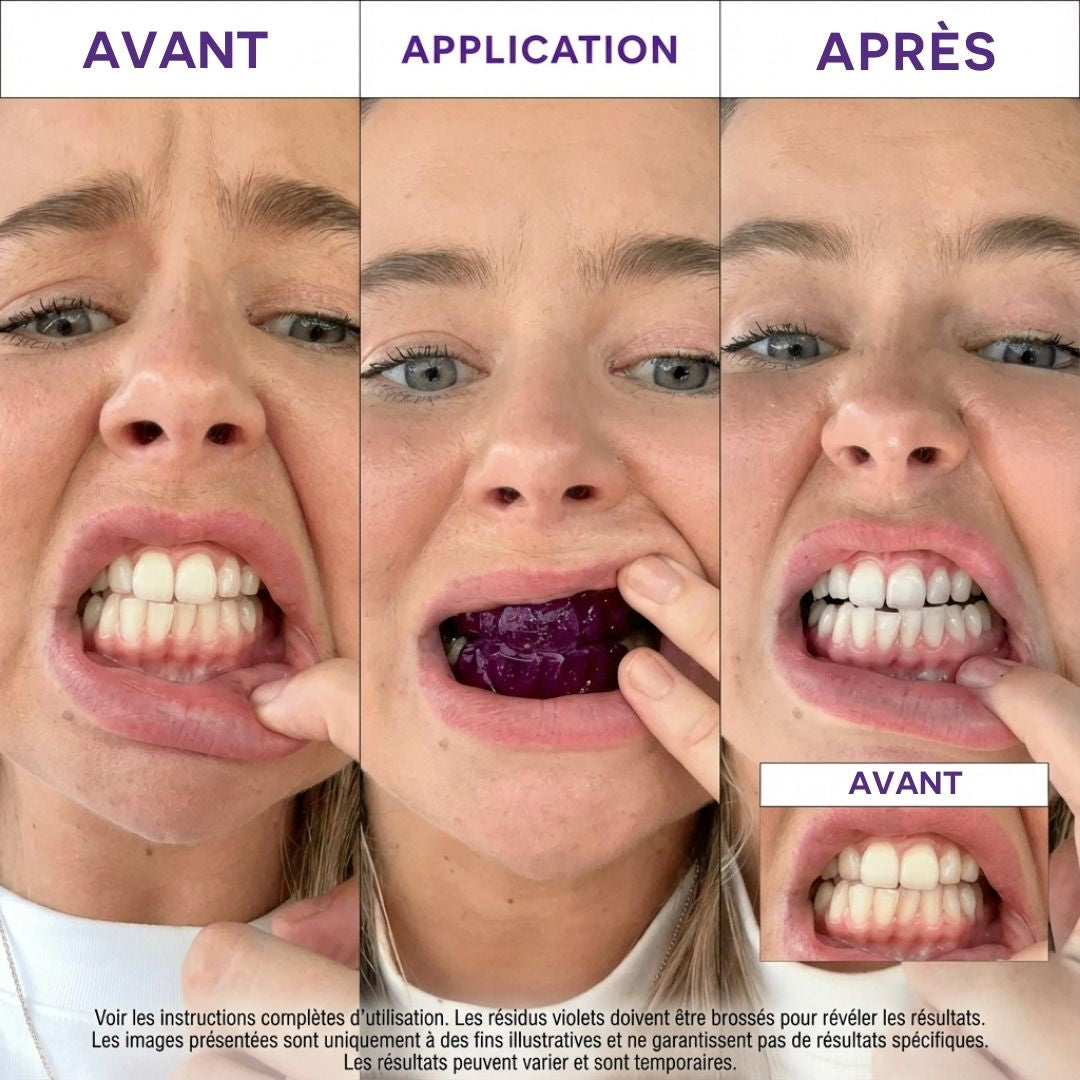 Bandes Blanchissantes PurpleWhite™