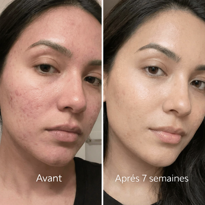Stick DermaRepair