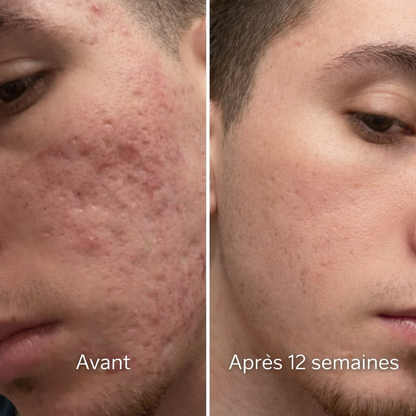 Stick DermaRepair