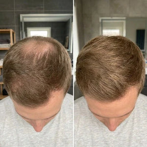Mathis review image