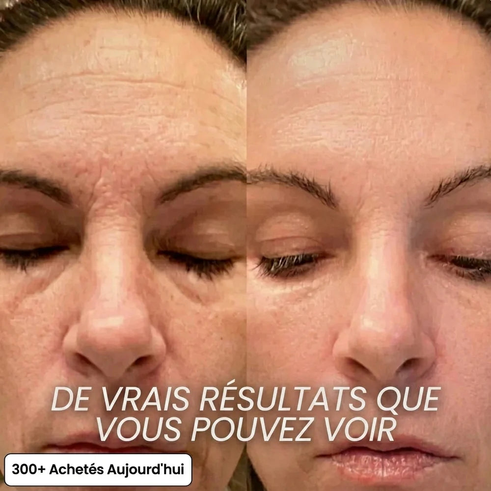 Stick Repulpant Bio-Collagène PDRN