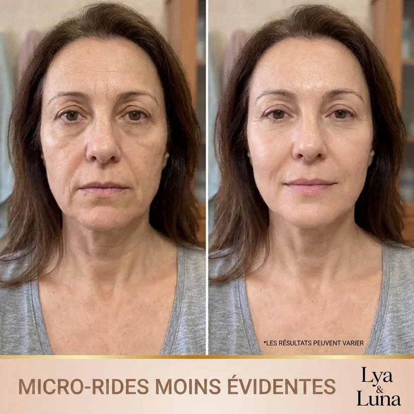 Korean Lifting Serum - Visible Results from First Use